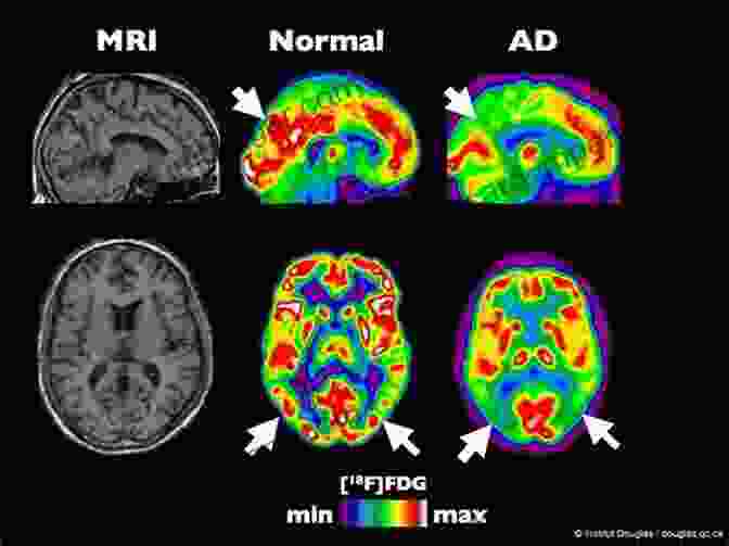 A Colorful Brain Scan Revealing Active Regions Secrets Of Creativity: What Neuroscience The Arts And Our Minds Reveal