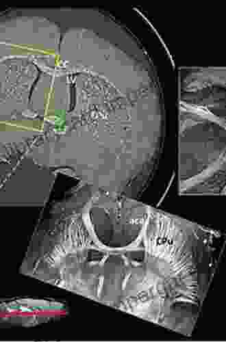 X Ray Phase Contrast Tomography: Underlying Physics And Developments For Breast Imaging (Springer Theses)